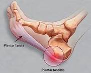 Superior hot sale calcaneal spur